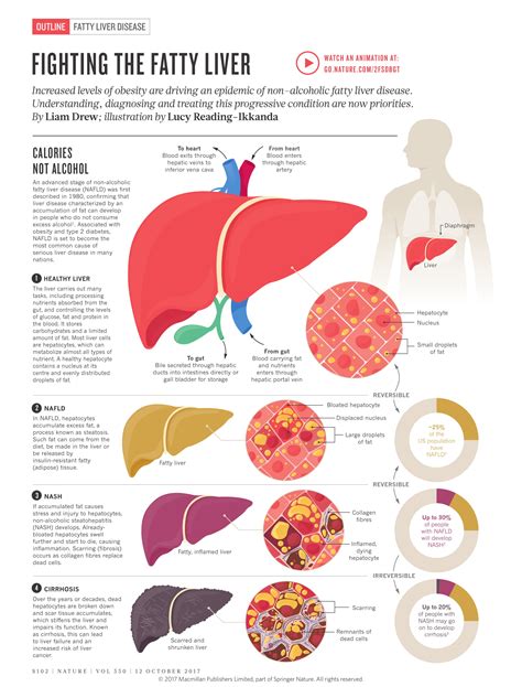 Fatty Liver Disease Care .